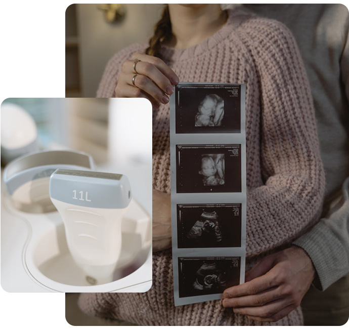 sippacs-pacs-radiology-sonograghy-graphic-software